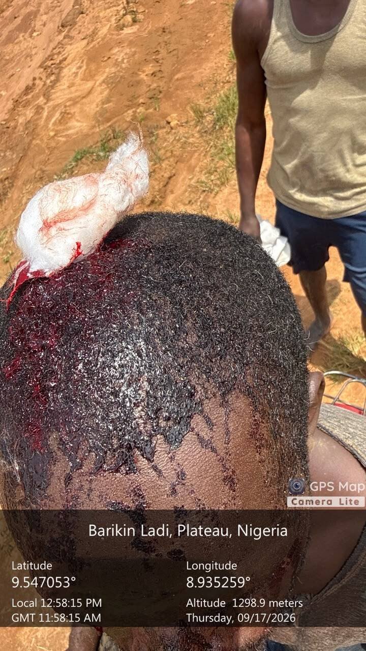 Suspected Fulani Bandits attack illegal miners, injure…