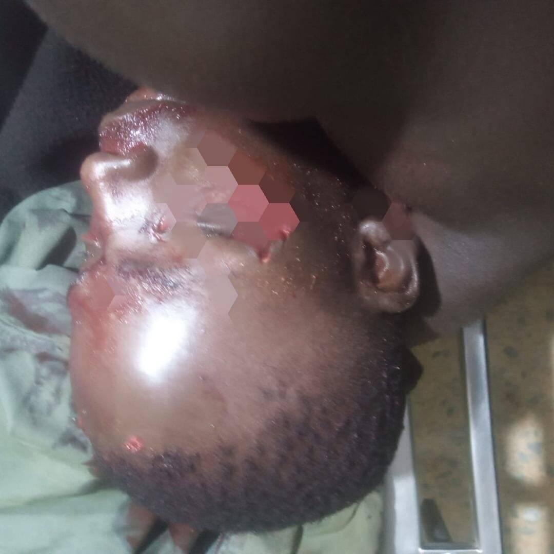 Suspected cattle rustlers injure youth in isolated…